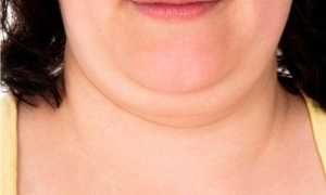 Как избавиться от второго подбородка с помощью массажа