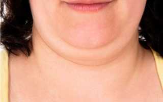 Как избавиться от второго подбородка с помощью массажа