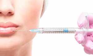 Чем лучше увеличить губы — ТОП-10 препаратов, советы по выбору