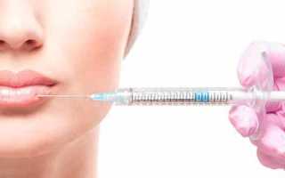 Чем лучше увеличить губы — ТОП-10 препаратов, советы по выбору