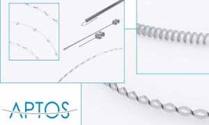 Нити Аптос — оправдана ли популярность отечественной продукции