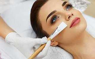 Какой кислотный пилинг для лица лучше использовать дома