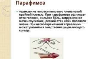 Боль при открытии головки