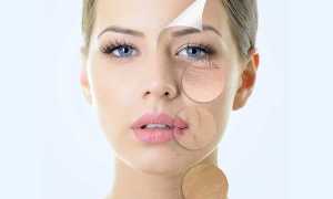 Биоармирование лица — эффективна ли процедура, в чем отличия от армирования