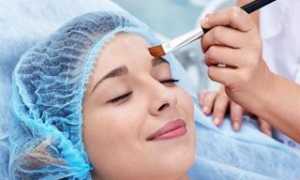 Пилинг Джесснера: все, что необходимо знать о процедуре