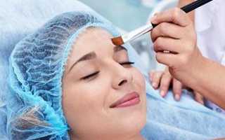 Пилинг Джесснера: все, что необходимо знать о процедуре