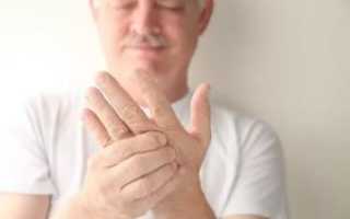 Повышено давление, немеют руки и лицо