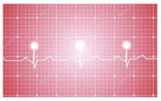 Связь кардиограммы и менструации