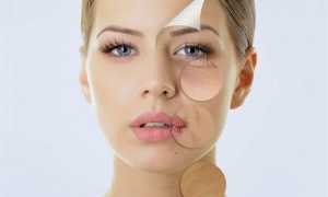 Биореволюметрия — моделирование лица инъекциями гиалуроновой кислоты