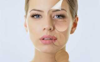 Биореволюметрия — моделирование лица инъекциями гиалуроновой кислоты