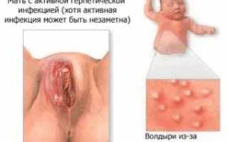 Ожог половых органов