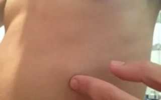 Под левым ребром небольшое уплотнение