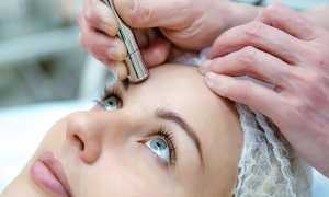 Алмазный пилинг: эффективная процедура очистки кожи или маркетинговая уловка