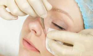 Что такое мануальная чистка лица и кому она подойдет