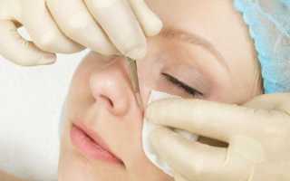 Что такое мануальная чистка лица и кому она подойдет