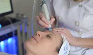 Пилинг Hydrafacial — революционная методика чистки лица