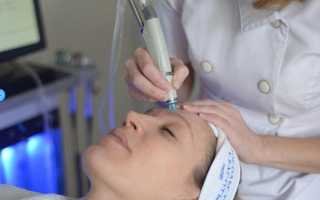 Пилинг Hydrafacial — революционная методика чистки лица
