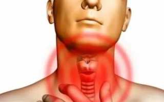 Тошнота в горле, что это может быть?