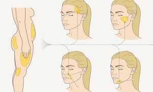 Липофилинг лица: опасна ли процедура и сколько длится эффект