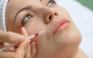 Биоревитализация при беременности — оправдан ли риск