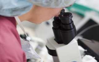 Что означает присутствие лейкоцитов в сперме