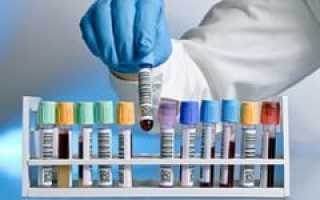 Анализ крови на АСТ