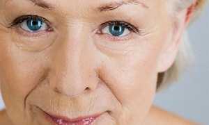 Подтяжка лица хирургическим путем: соответствует ли цена операции ее результату