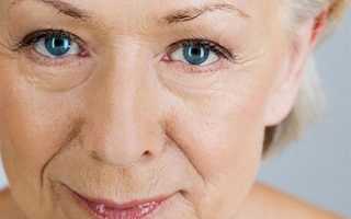 Подтяжка лица хирургическим путем: соответствует ли цена операции ее результату