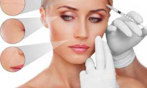 Противопоказания и вред для организма от инъекций ботокса