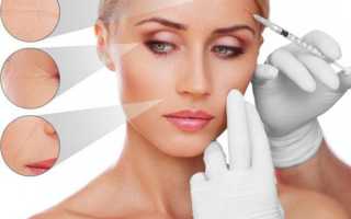 Противопоказания и вред для организма от инъекций ботокса