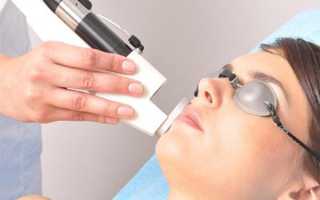 Удаление пигментных пятен на лице лазером: высоки ли риски и эффективность