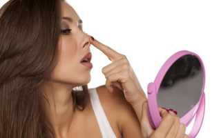 Как проводится контурная пластика носа — важные особенности о которых нужно знать