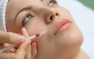 Биоревитализация в домашних условиях — насколько эффективна процедура и возможен ли от неё вред