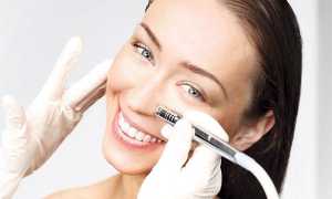 Что такое дермабразия лица, с какими проблемами она справляется