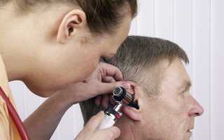 Симптомы и методы лечения кохлеарного неврита слухового нерва