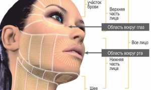 Альтеротерапия — эффективная безоперационная подтяжка лица или бесполезная трата денег