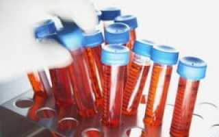 Анализ крови на аллергены