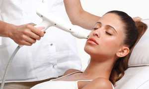 Лазерная подтяжка лица — можно ли вернуть молодость без операции и уколов