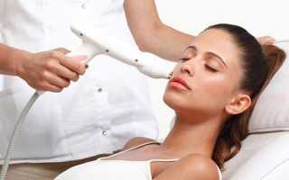 Лазерная подтяжка лица — можно ли вернуть молодость без операции и уколов
