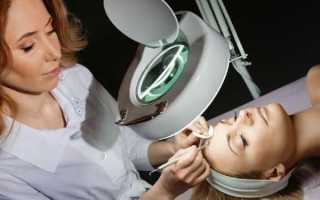 Комбинированная чистка лица: что входит в процедуру, какой эффект она дает