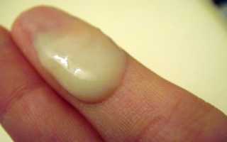 Какого цвета должна быть сперма?