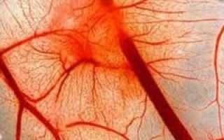 Нарушение кровообращения