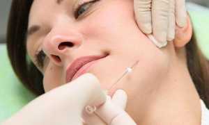 3D-нити Дарвин — полный обзор, сравнение с аналогами