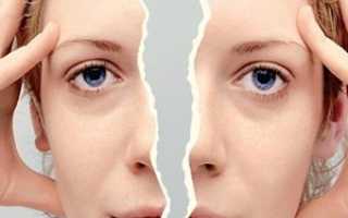 Пограничное расстройство личности