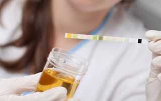 Причины повышенного содержания белка в мужской моче