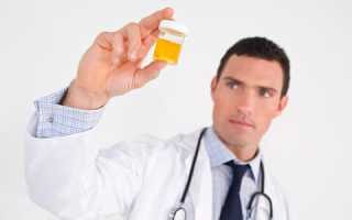 Почему у мужчин в моче появляются белые хлопья