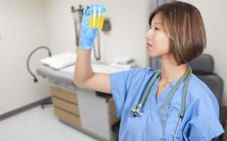 Первый этап формирования почечных камней