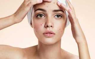 Лучшие пилинги для проблемной кожи: салонные процедуры и домашние средства