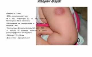 Уплотнение на месте прививки БЦЖ