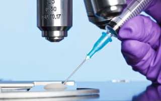 Лабораторное исследование семенной жидкости